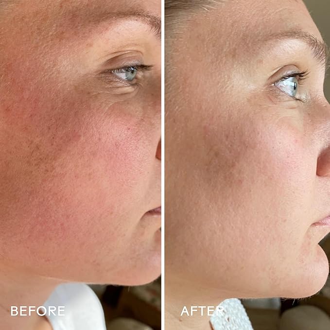 Three Ships - SkinHero Calendula + 2% Bakuchiol Bio-Retinol Serum | Firm, Soothe, Hydrate Skin | Cruelty-Free, Vegan, Paraben-Free, Sensitive Skin Safe (1 fl oz | 30 mL)