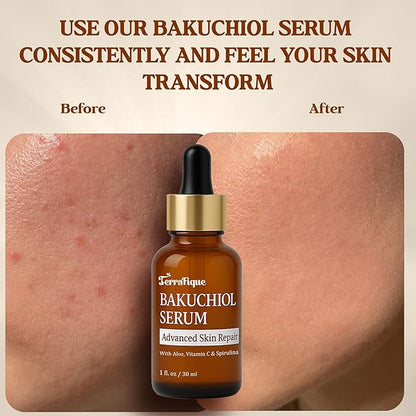 Bakuchiol Serum for Face - Retinol Alternative for Sensitive Skin - Contains Aloe, Centella, Spirulina - Bakuchiol Retinol Serum - Plumping, Anti Aging - Pore Minimizer - 1 Fl Oz - 2 Pack